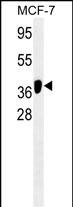 WB - ATG4B Antibody AM1902b